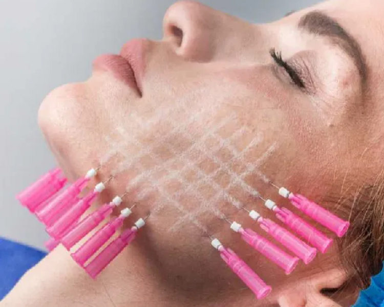 Hilos Revitalizantes rostro