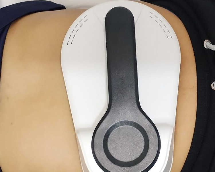 5 Sesiones: Criolipólisis + Tonificación Muscular 