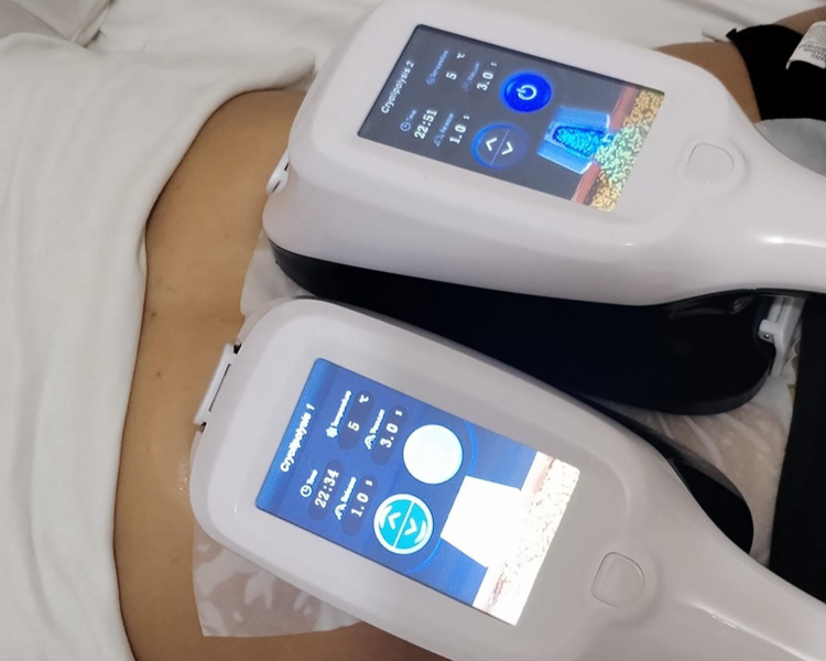 Sesión Individual: Criolipólisis + Tonificación Muscular 