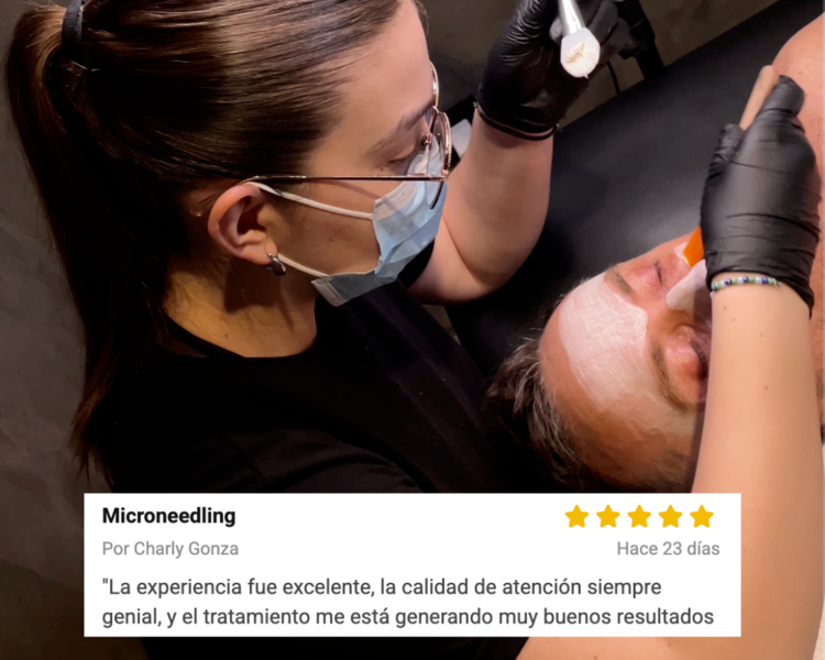 Microneedling