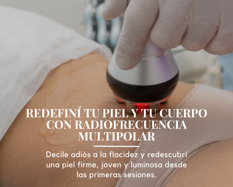 Radiofrecuencia Multipolar 