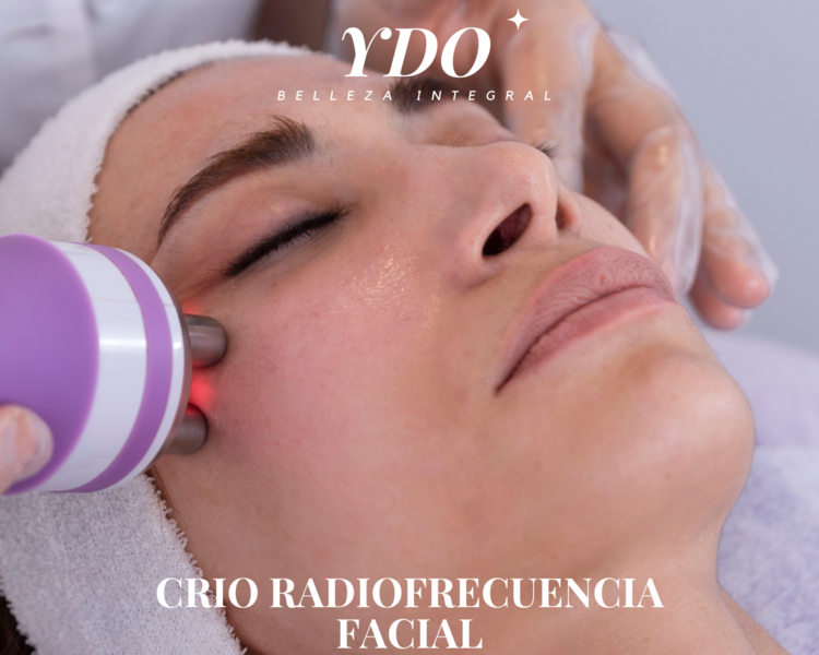 Crio Radio frecuencia Facial