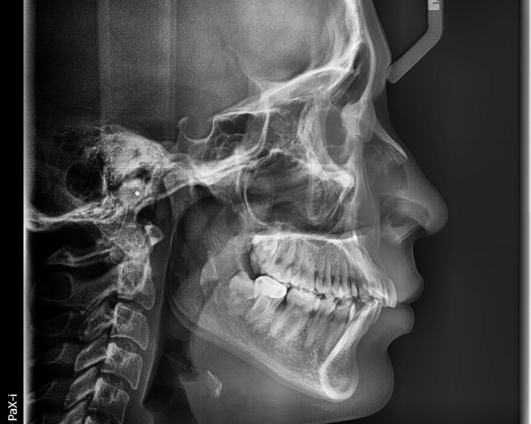 RX 2.1   RADIOGRAFIA PANORAMICA Y RADIOGRAFIA LATERAL DE CRANEO