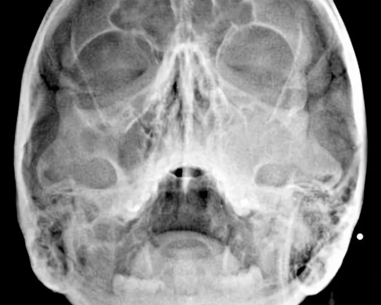 RX 8  RADIOGRAFIA CADWELL