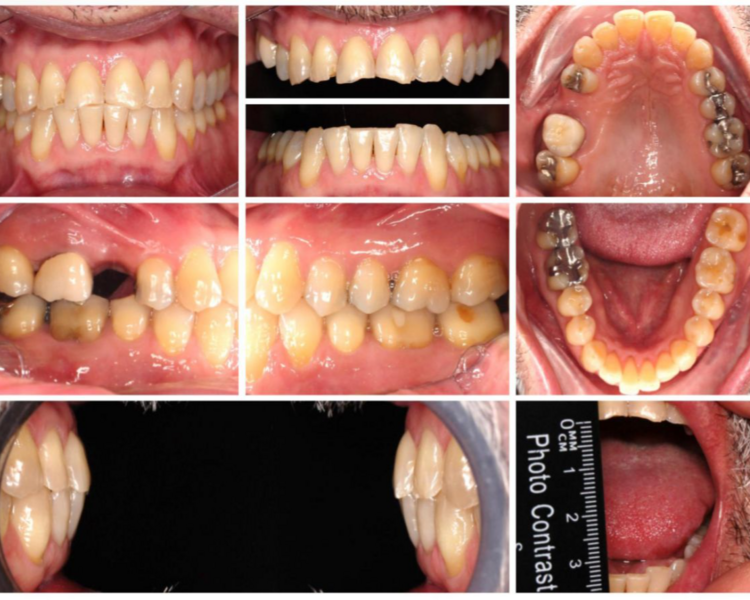 FOTOGRAFIA ORTODONCIA  