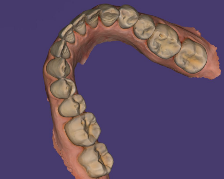 ESTUDIO COMPLETO DE ORTODONCIA CON ESCANER Y MODELOS 3D
