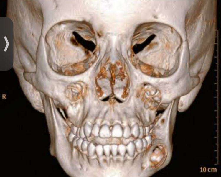 TOMOGRAFÍA  PARA ORTONDONCIA 