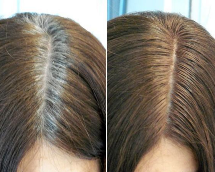 Retoque de Raiz (Tinte)