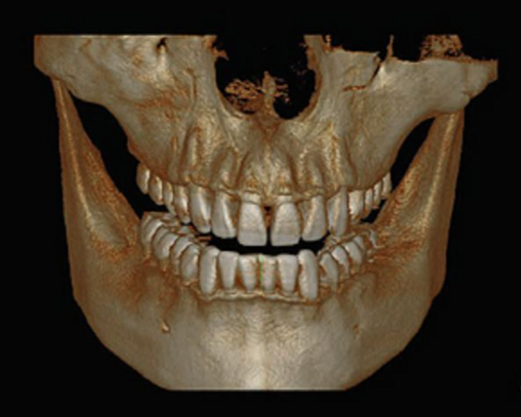 TOMOIGRAFIA AMBAS ARCADAS ( FOV  12X 9 )
