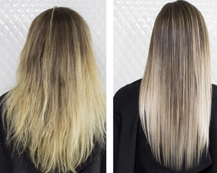 BOTULINICA YBERA PARIS