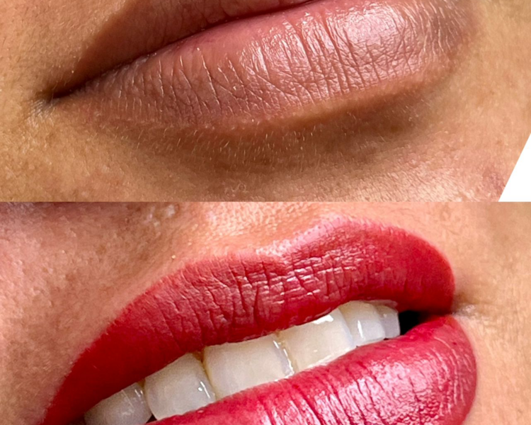 Neutralización de labios manchados + Color deseado