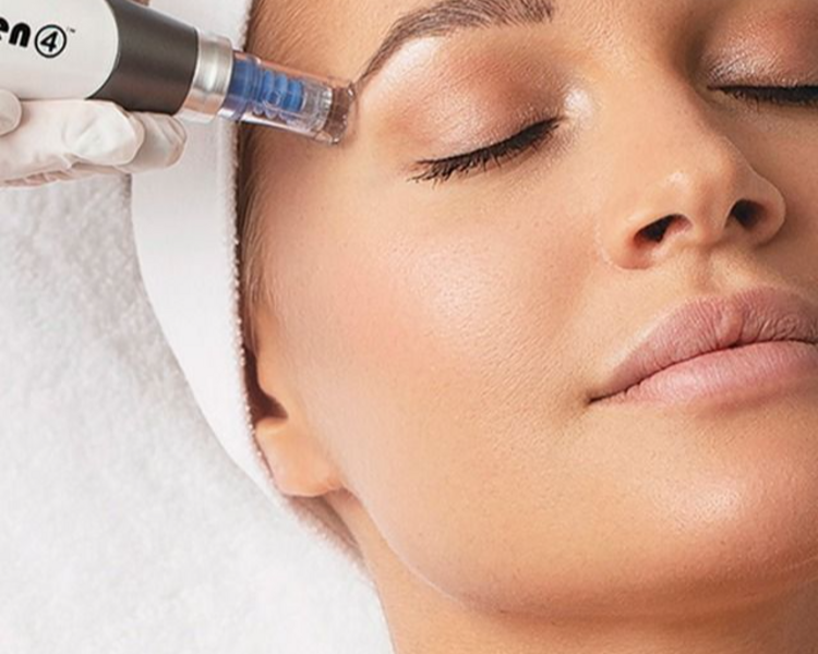 Microneedling (Dermapen) más limpieza profunda 
