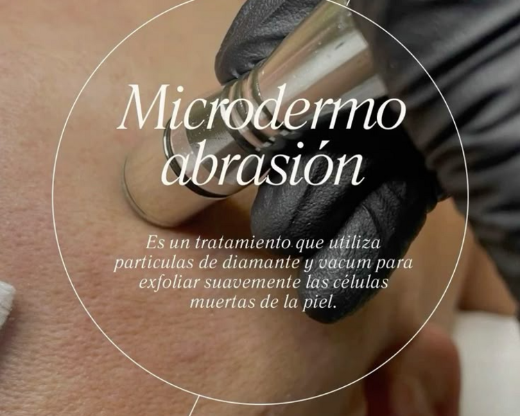 limpieza profunda +microdermoabrasión (punta de diamantes)