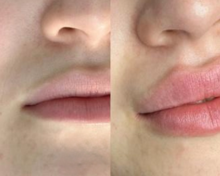 Glinity Lips
