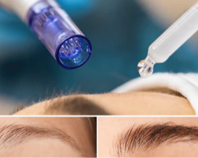 Restauracion de cejas