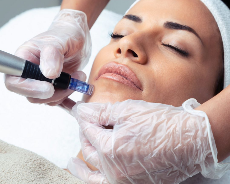 Dermapen