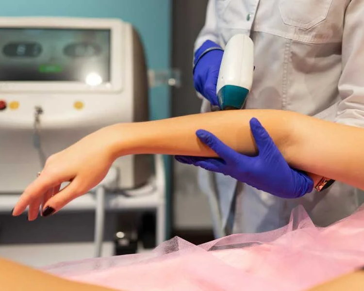 Láser medios brazos 10 sesiones