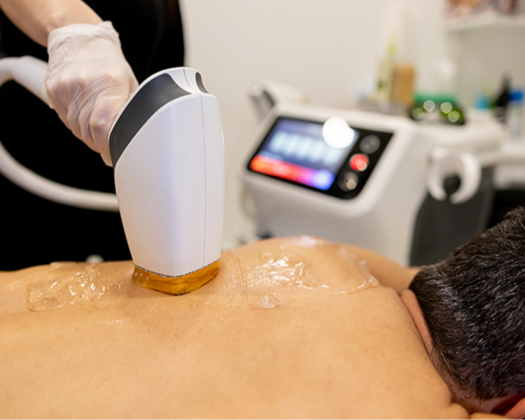 Láser media espalda 6 sesiones