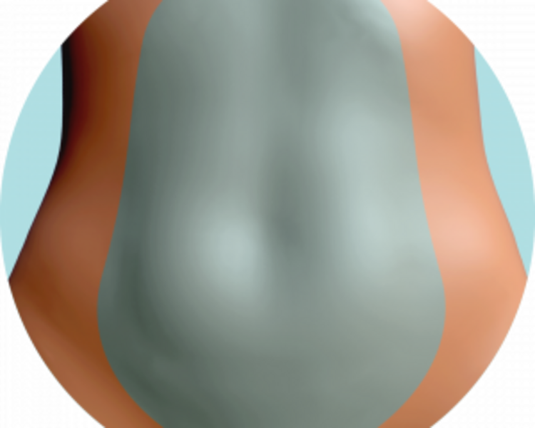 Láser en pubis 10 sesiones