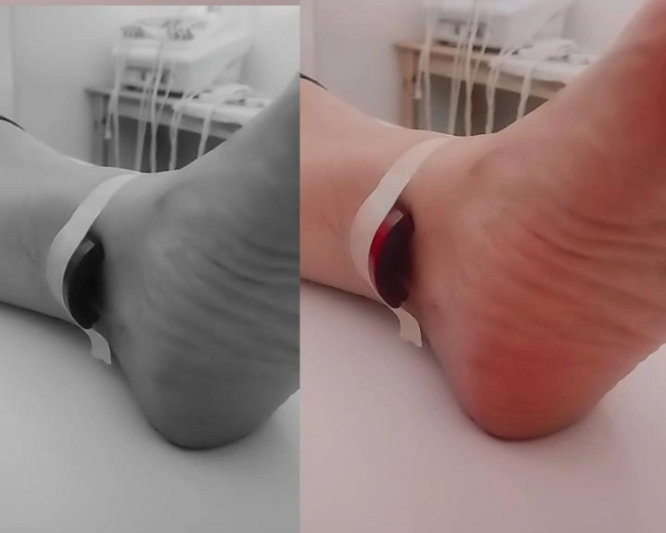 Reflexologia Podal  + Magnetoterapia 