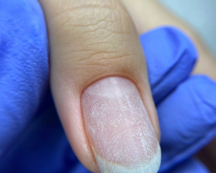 Retiro de semi + hidratacion