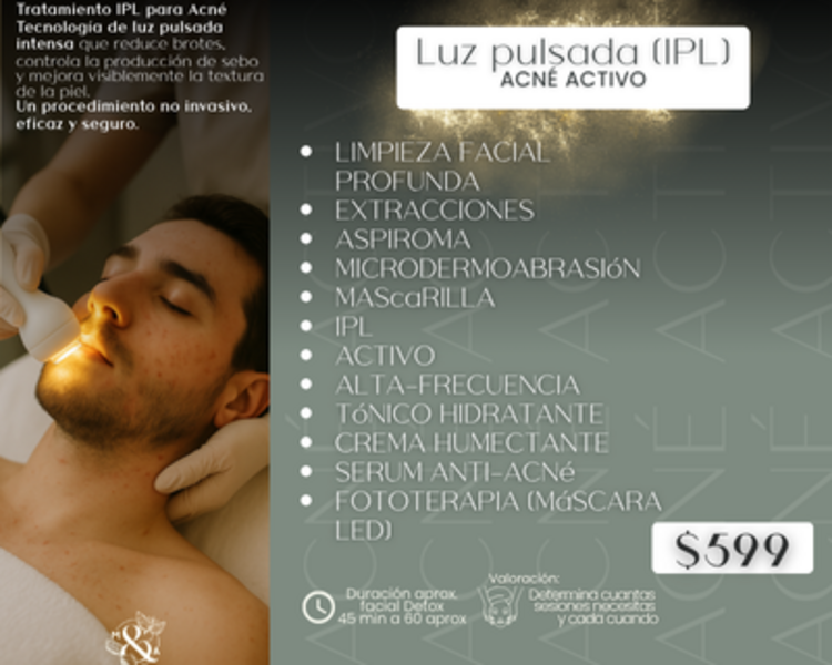 Luz pulsada (IPL) ACNÉ ACTIVO