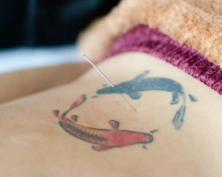 Sesión Integral de Medicina Tradicional China