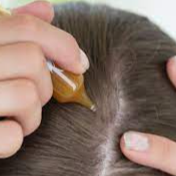 CONTROL CAIDA 8 SESIONES 