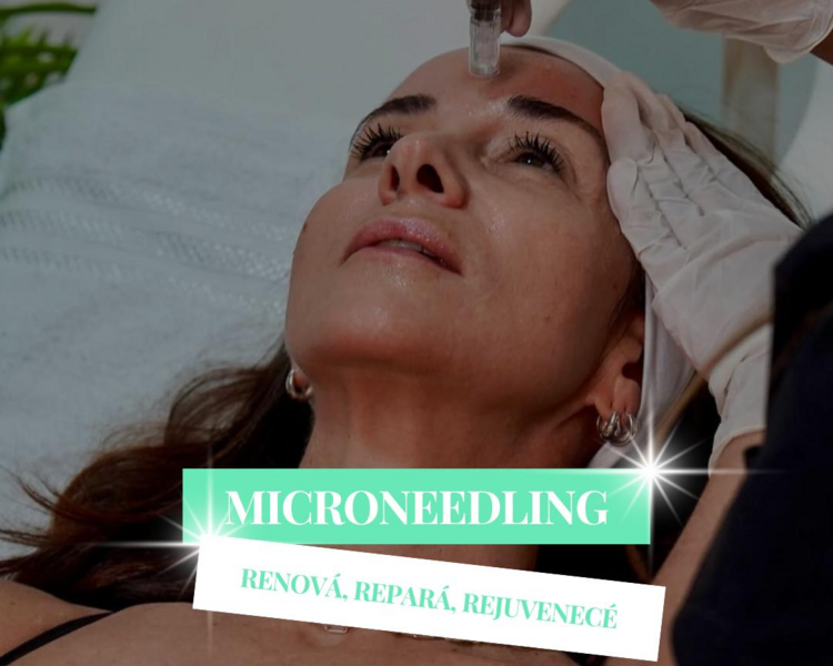 MICRONEEDLING -BBGLOW
