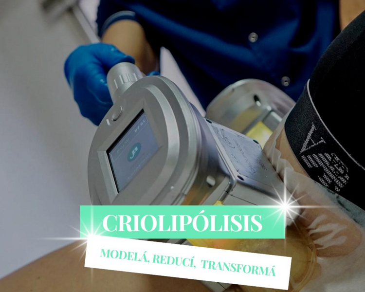CRIOLIPOLISIS - 02 ZONAS