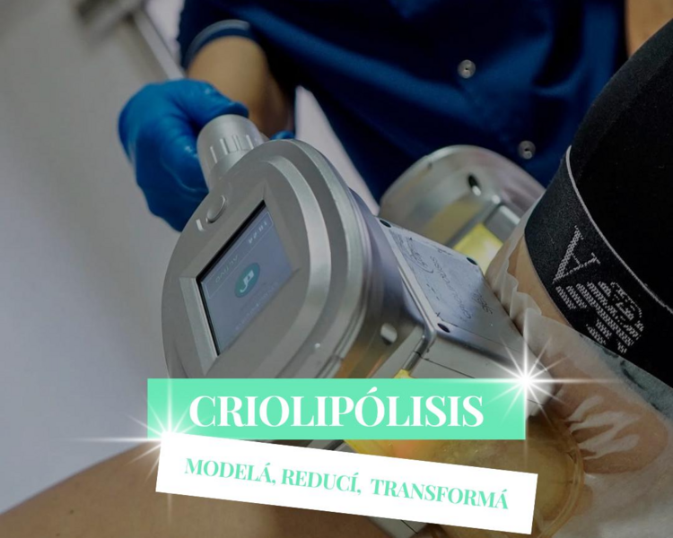 CRIOLIPOLISIS - 02 ZONAS + MASAJE