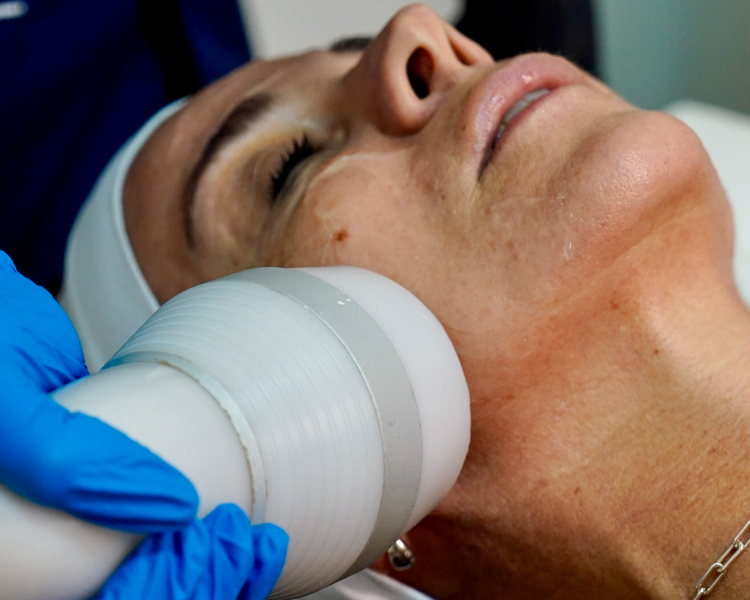 CRIORADIOFRECUENCIA - FACIAL