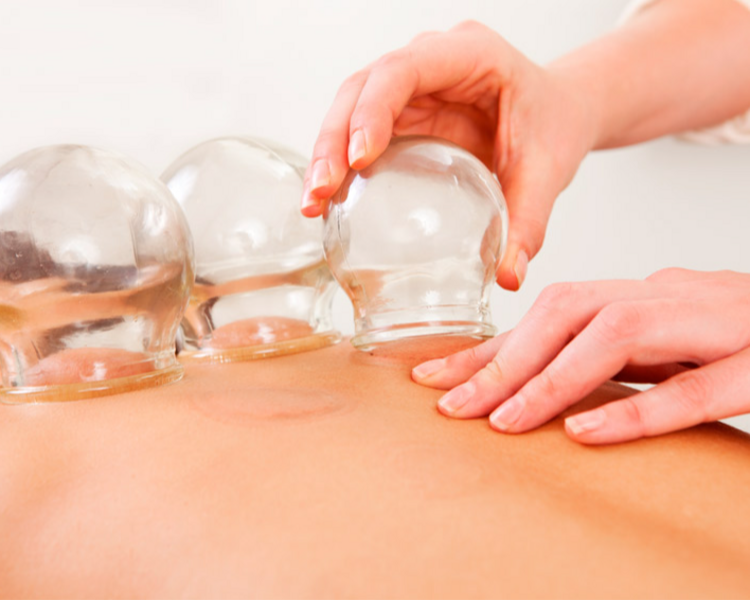 Ventosas Chinas (vasos de vidrio)