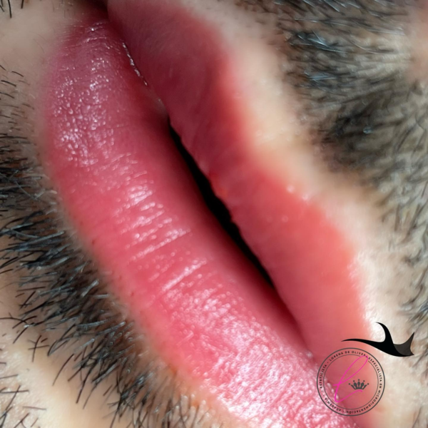 Revitalizacion Labial Masculino