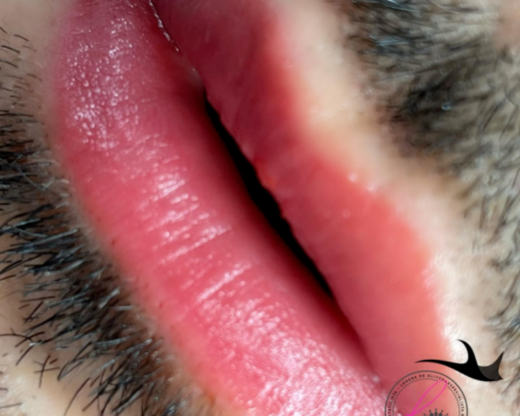 Revitalizacion Labial Masculino