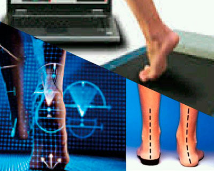 Estudio baropodométrico para uso de plantillas