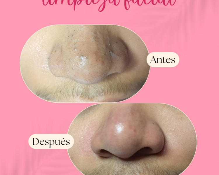 Facial personalizado 