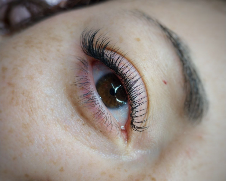 Extensiones Clásicas