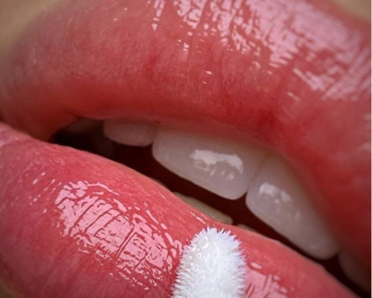 Servicio Hidraluxe lips