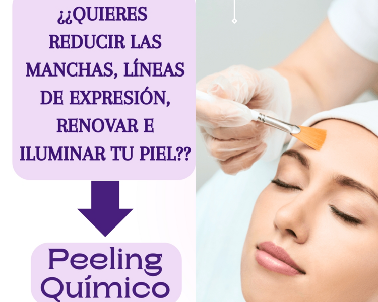Peeling Químico 