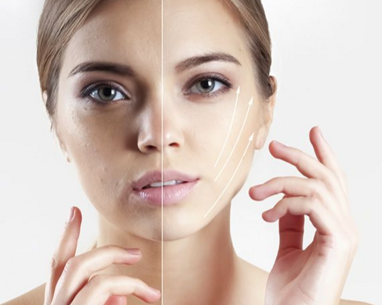 DMAE (Flacidez y Envejecimiento)