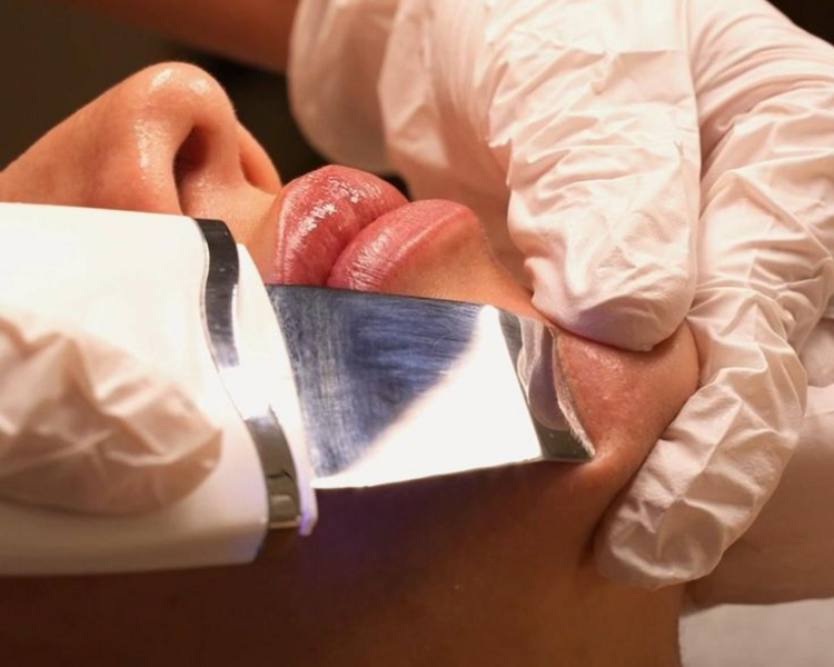 Higiene Facial Profunda (con extracciones)