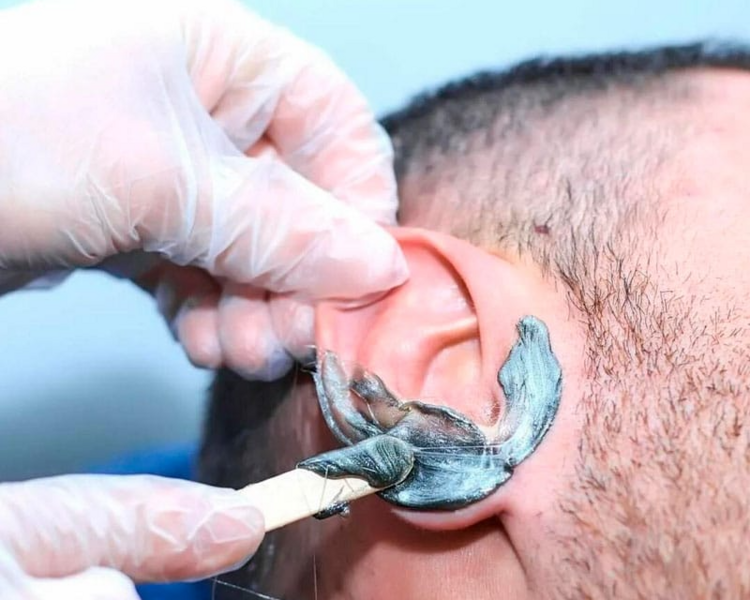 Depilación de Orejas con Cera