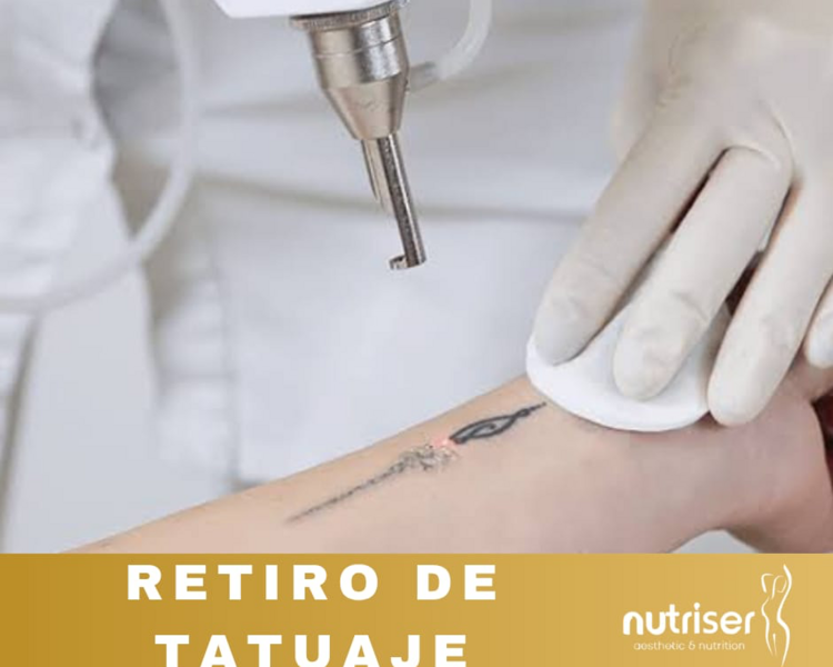 Eliminación o Desvanecimiento de Tatuajes