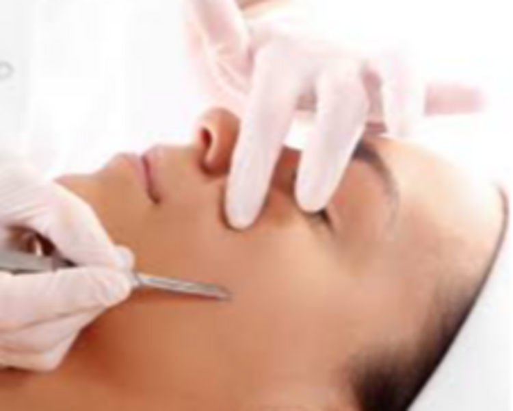 DERMAPLANING