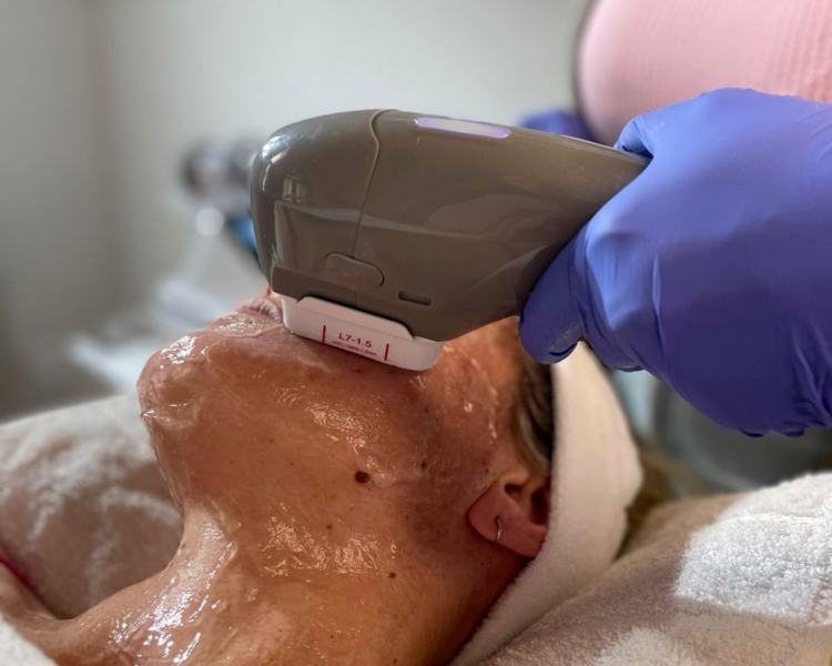 Hifu Rostro Completo 