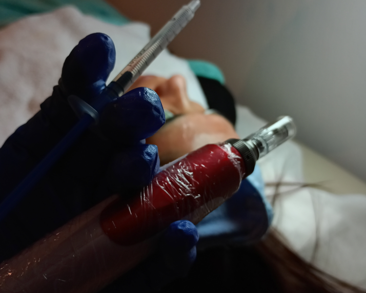 Tratamiento facial Microneedlig . Rejuvenecimiento 
