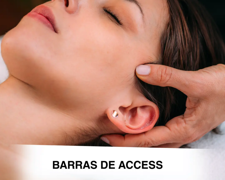 Barras de access