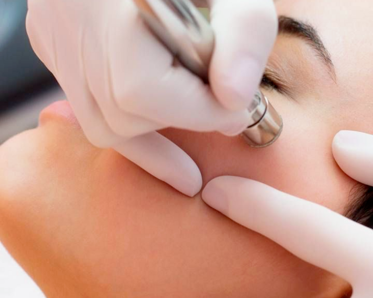 Limpieza Facial Profunda (PARTICULAR)