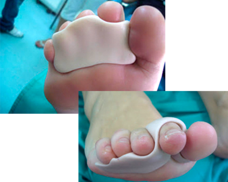 Ortesis de silicona 4gr